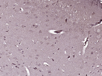 PDK1/Mitochondrial Pyruvate dehydrogenase kinase 1 Rabbit Polyclonal Antibody