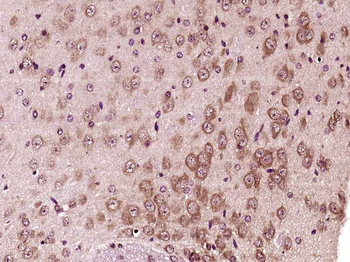 PFKFB3/PFK2 Rabbit Polyclonal Antibody
