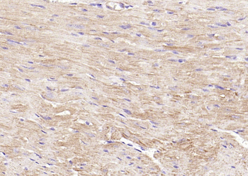 PI 3 Kinase Class 3 Rabbit Polyclonal Antibody