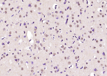 PGAM1 Rabbit Polyclonal Antibody