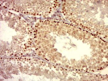 Phospho-PIM1 (Tyr309) Rabbit Polyclonal Antibody