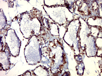 Phospho-PIM1 (Tyr309) Rabbit Polyclonal Antibody