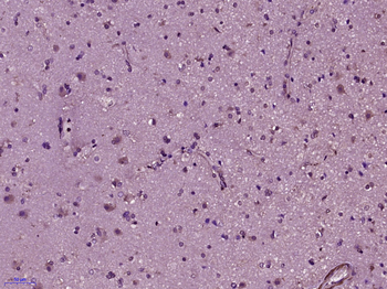PKA C alpha + beta Rabbit Polyclonal Antibody