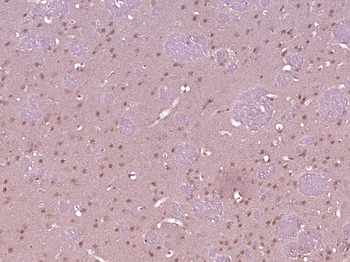 PLASTIN3 Rabbit Polyclonal Antibody