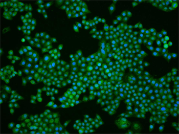 Phospho-PLCB3 (Ser1105) Rabbit Polyclonal Antibody