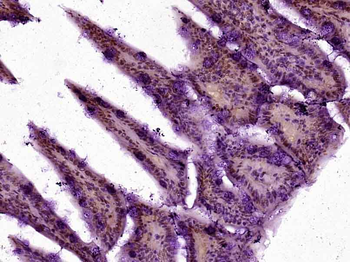 PP1C gamma Rabbit Polyclonal Antibody