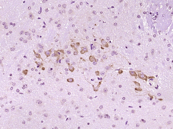 PP2CA Rabbit Polyclonal Antibody