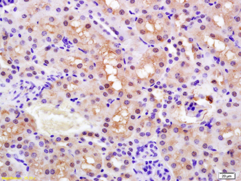 Phospho-PPAR alpha (Ser12) Rabbit Polyclonal Antibody