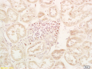 PHD2 Rabbit Polyclonal Antibody