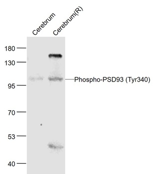 PSD93 (phospho-Tyr340) antibody