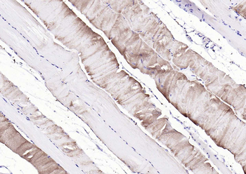 PYGM Rabbit Polyclonal Antibody