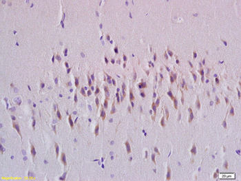 Rab24 Rabbit Polyclonal Antibody