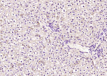 Radixin Rabbit Polyclonal Antibody