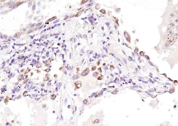 Phospho-Raptor (Ser792) Rabbit Polyclonal Antibody