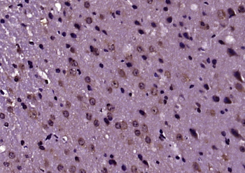 Phospho-Raptor (Ser792) Rabbit Polyclonal Antibody