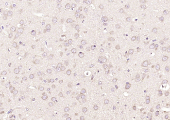 RASGRF1 Rabbit Polyclonal Antibody