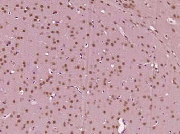 Phospho-Rb (Ser249) Rabbit Polyclonal Antibody