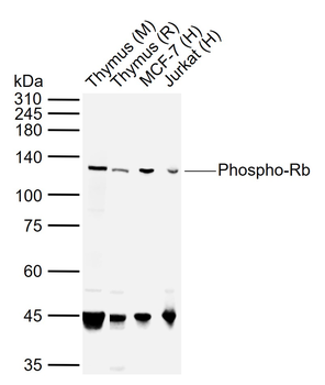 Phospho-Rb (Thr821) Rabbit Polyclonal Antibody
