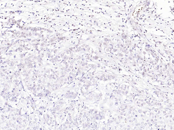 Phospho-Rb (Ser612) Rabbit Polyclonal Antibody