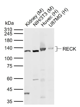 RECK Rabbit Polyclonal Antibody