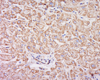 SDHA Rabbit Polyclonal Antibody