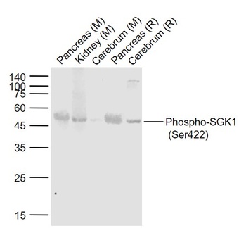 SGK1 (phospho-Ser422) antibody