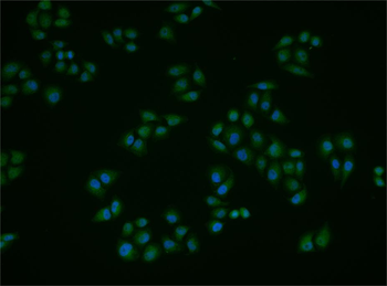 Phospho-SGK1 (Thr256) Rabbit Polyclonal Antibody