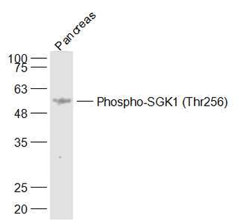Phospho-SGK1 (Thr256) Rabbit Polyclonal Antibody