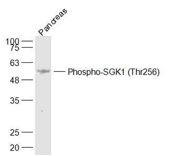 SGK1 (phospho-Thr256) antibody