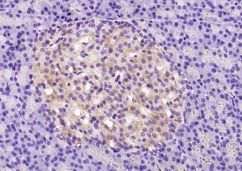 SLC39A7 Rabbit Polyclonal Antibody