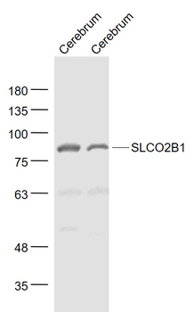 SLCO2B1 Rabbit Polyclonal Antibody