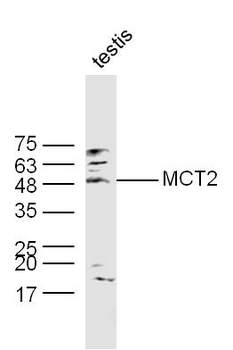 MCT2 Rabbit Polyclonal Antibody