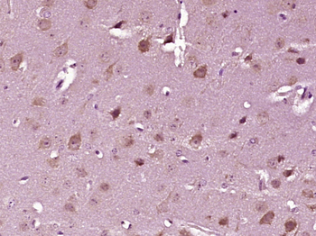 Phospho-MYPT1 (Thr853) Rabbit Polyclonal Antibody