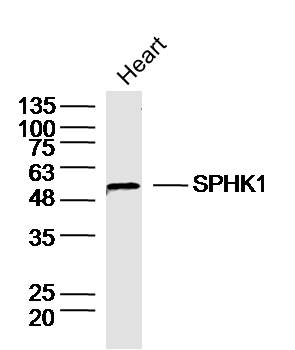 SPHK1 Rabbit Polyclonal Antibody