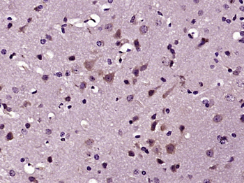 Phospho-Src (Tyr418) Rabbit Polyclonal Antibody