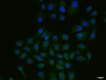 Src (phospho-Tyr215) antibody