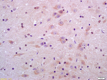 Sulfatase 2 Rabbit Polyclonal Antibody