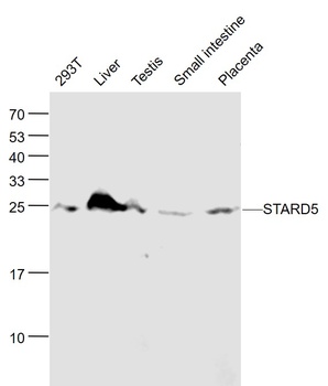 STARD5 antibody