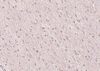 HMGB1 Rabbit Polyclonal Antibody