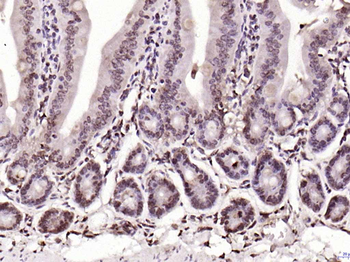 BLM Rabbit Polyclonal Antibody