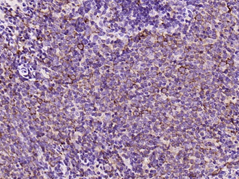 CXCR5 Recombinant Rabbit Monoclonal Antibody