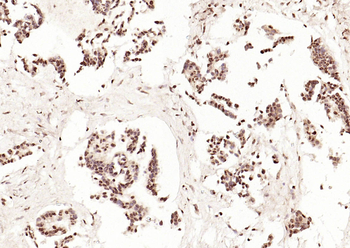 CDKN1A/p21 Rabbit Polyclonal Antibody
