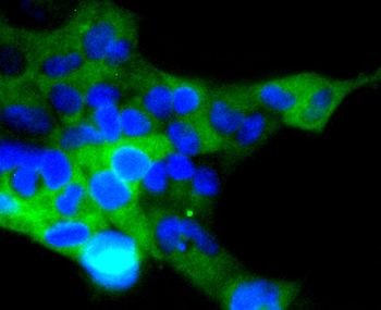ACE2 Recombinant Rabbit Monoclonal Antibody