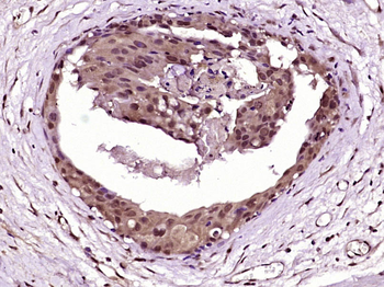 RAF1 Rabbit Polyclonal Antibody