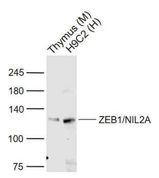 ZEB1/NIL2A Rabbit Polyclonal Antibody