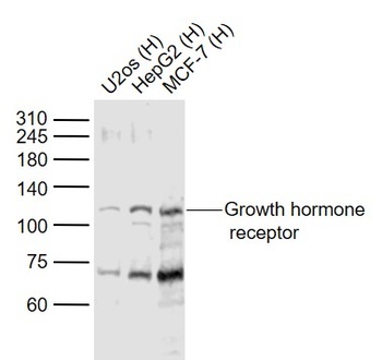 Growth Hormone Receptor antibody