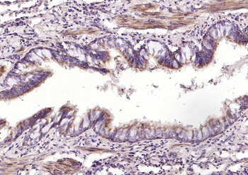 CATSPER Rabbit Polyclonal Antibody