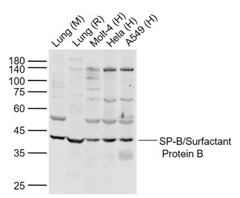 SP-B antibody