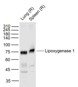15 Lipoxygenase 1 antibody