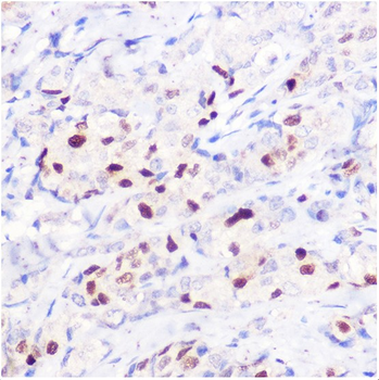 P21 Rabbit Polyclonal Antibody